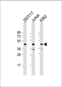 PHF6 Antibody (Center)