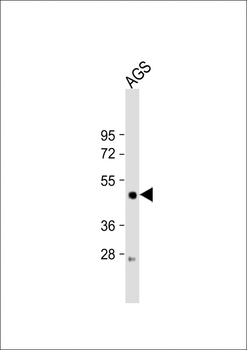 LIPF Antibody (Center)