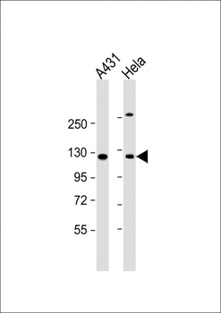 INTS6 Antibody (N-Term)