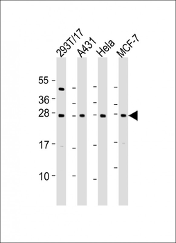RPL14 Antibody (C-Term)