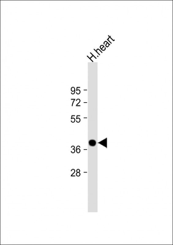 NMNAT1 Antibody (C-Term)