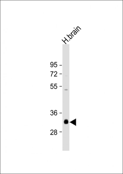 NMNAT1 Antibody (C-Term)