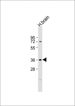 NMNAT1 Antibody (C-Term)