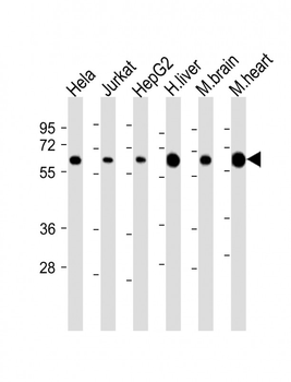 PGM1 Antibody (Center)