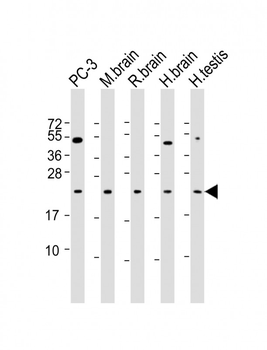 RAB18 Antibody
