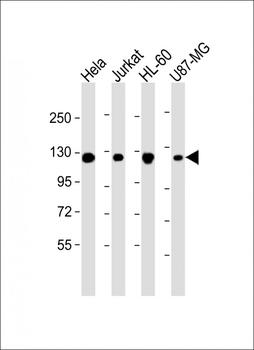 RNF20 Antibody
