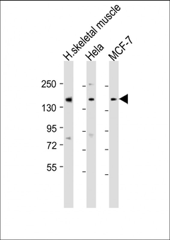 TNRC6A Antibody (Center)