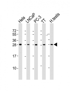 SSX1 Antibody (Center)