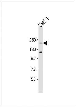 TRIP12 Antibody (Center)
