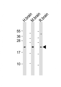 FGF12 Antibody (Center)