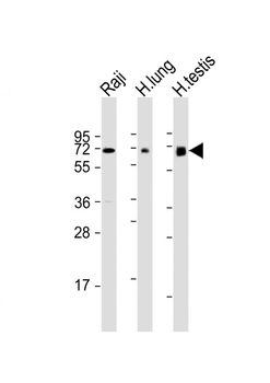 ERVK-7 Antibody (N-Term)