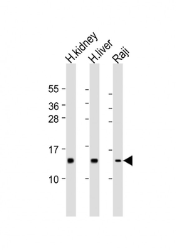 NDUFS5 Antibody (N-Term)