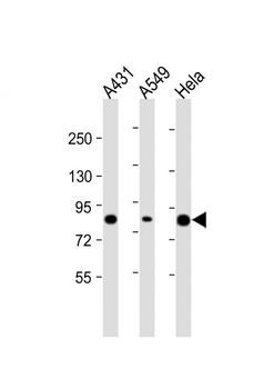 PLA2G4D Antibody (C-Term)