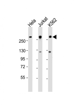 CHD3 Antibody (N-Term)