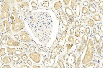 TIMP2 Antibody