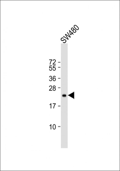 TIMP2 Antibody