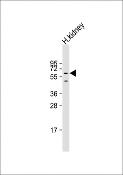 DMRT2 Antibody (N-Term)