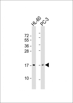 GRP Antibody (Center)