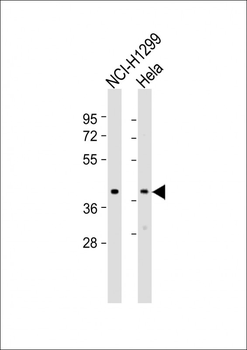 TWF1 Antibody (Center)