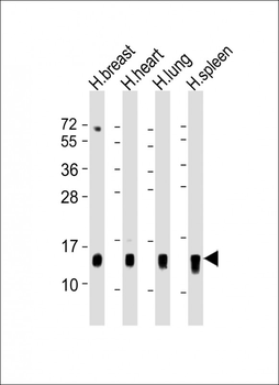 S100A9 Antibody (Center)