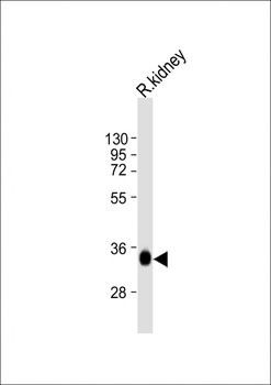 TST Antibody (C-Term)