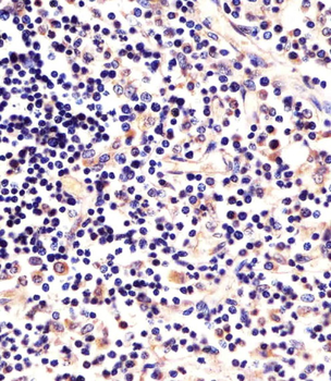 LCK Antibody