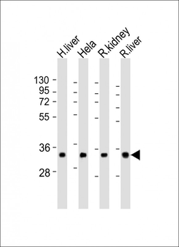 TST Antibody (Center)