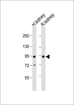 SLC26A4 Antibody (C-Term)