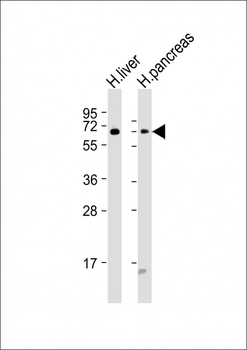 GCKR Antibody (N-Term)