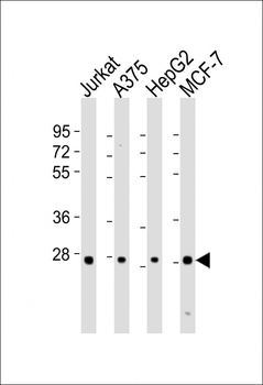 PSMB7 Antibody (Center)