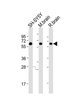 DPYSL5 Antibody