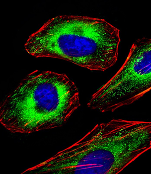FOXO4 Antibody (Center)
