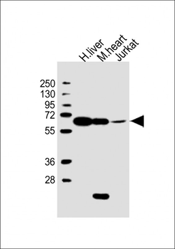 PGM1 Antibody (C-Term)