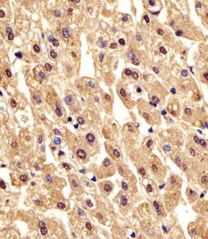PGM1 Antibody (C-Term)
