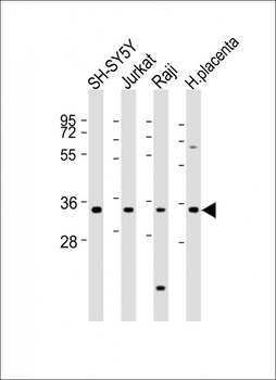 RASSF2 Antibody (Center)