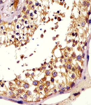 KISS1 Antibody (N-Term)