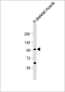 YY1AP1 Antibody (Center)