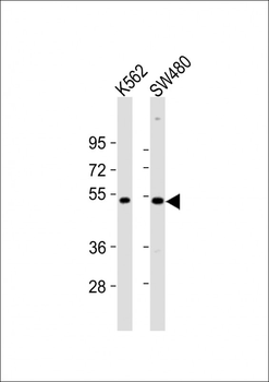 PRKAR2A Antibody (C-Term)
