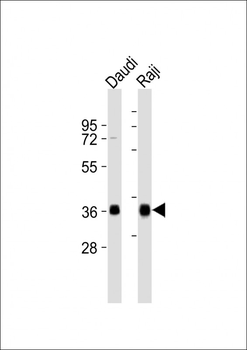 HLA-DQA1 Antibody (C-term)