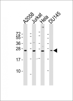 FGF11 Antibody (N-term)