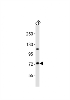 TAB2 Antibody (C-term)