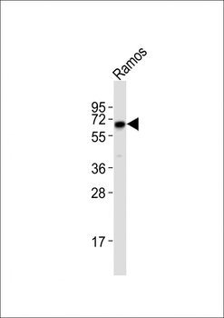 IL28RA Antibody (Center)