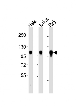 ITGA7 Antibody (C-term)