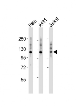 ITGA7 Antibody (N-term)