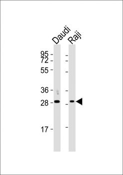 HLA-DQA1 Antibody (N-term)