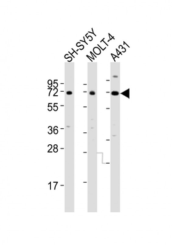 HTR2C Antibody (Center)