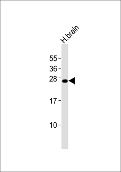 FGF14 Antibody (C-term)