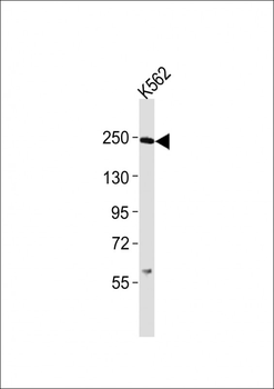 (Mouse) Smarca4 Antibody (C-term)