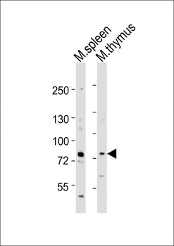 (Mouse) Melk Antibody (Center)