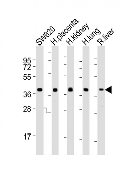 PPAP2B Antibody (N-term)